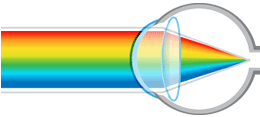 Eyes implanted with intraocular lenses